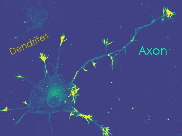 Axon development representing brain development research