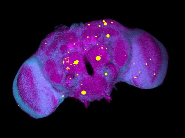 Abstract image representing neurodegeneration research